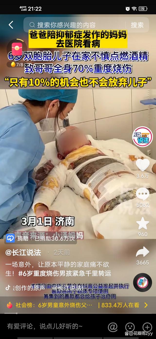 济南6岁男孩全身70%重度烧伤，千里转运至武汉，爸爸割皮救子