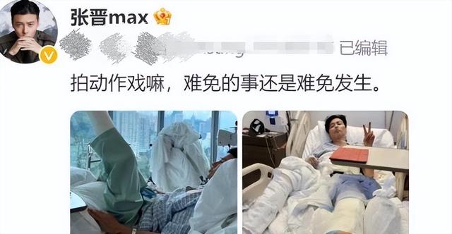 突发意外！演员“张晋”拍戏受重伤住院